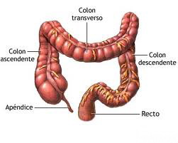 Operacion cancer de colon complicaciones
